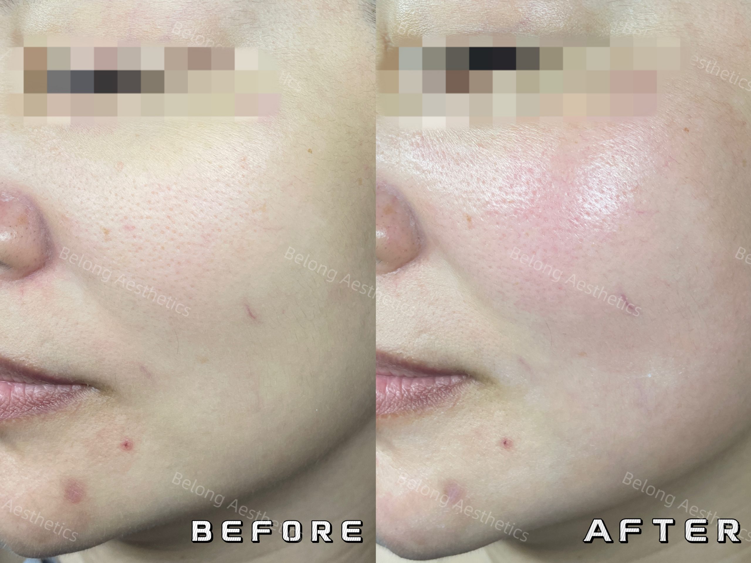 Before & After_Testimonial images_3261