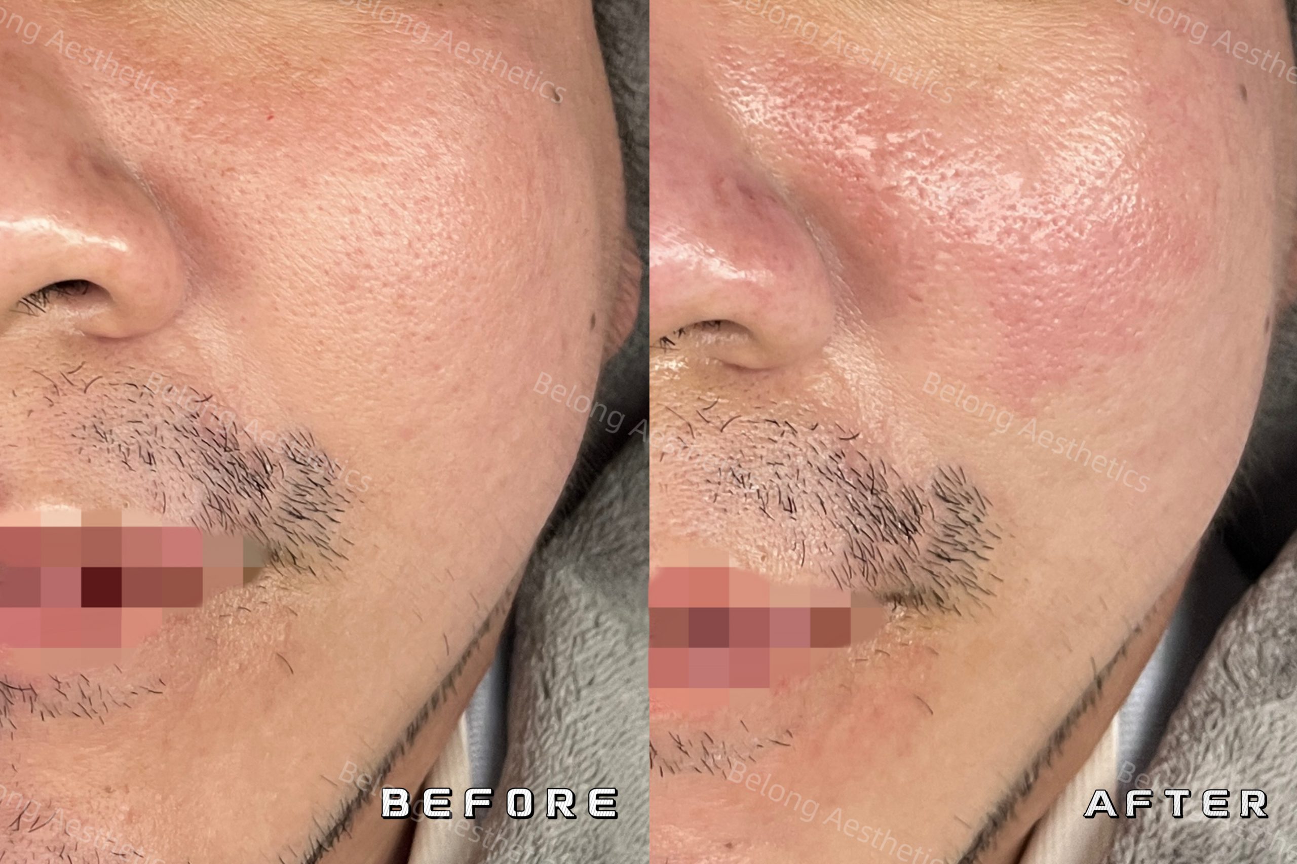 Before & After_Testimonial images_3274