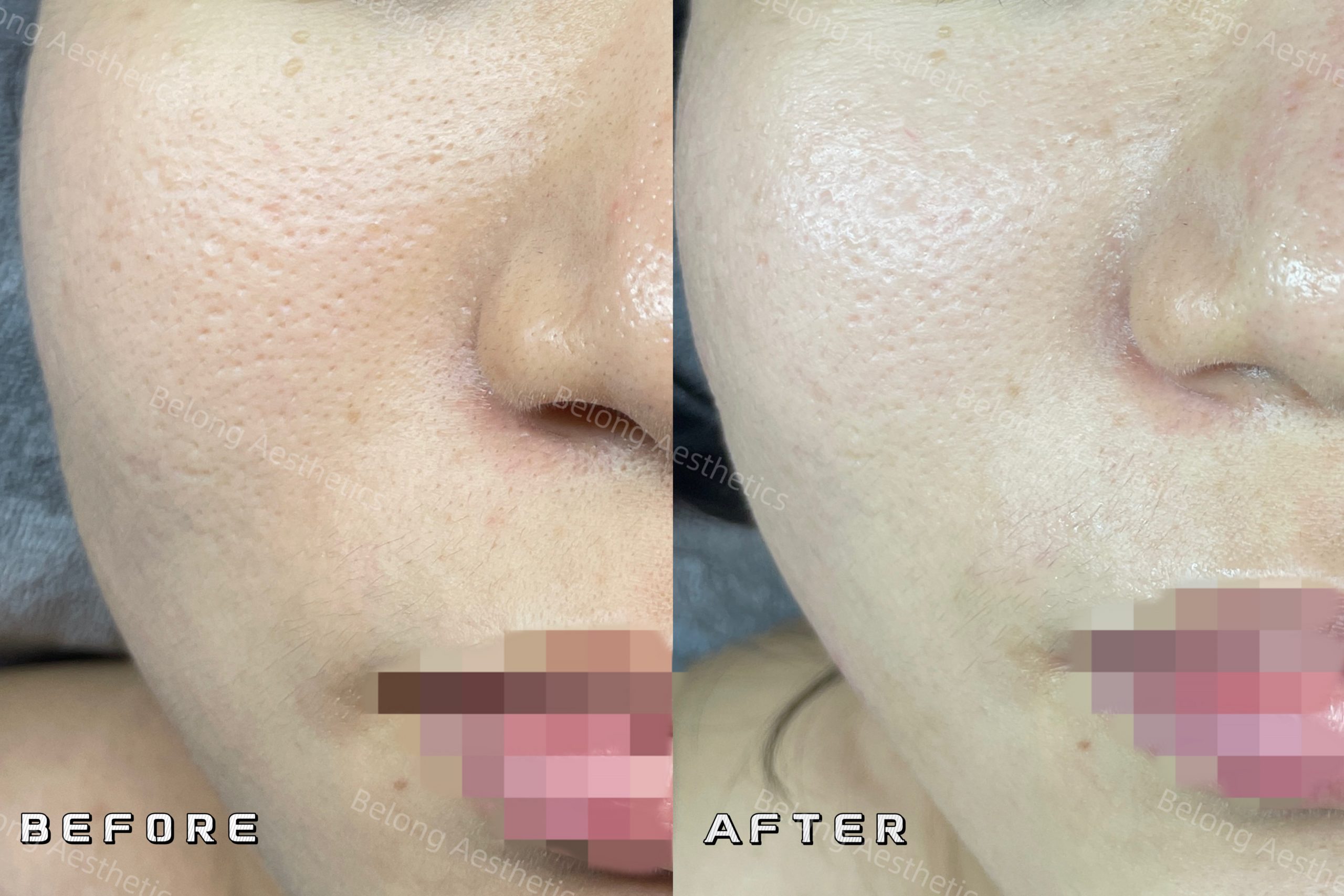 Before & After_Testimonial images_3276