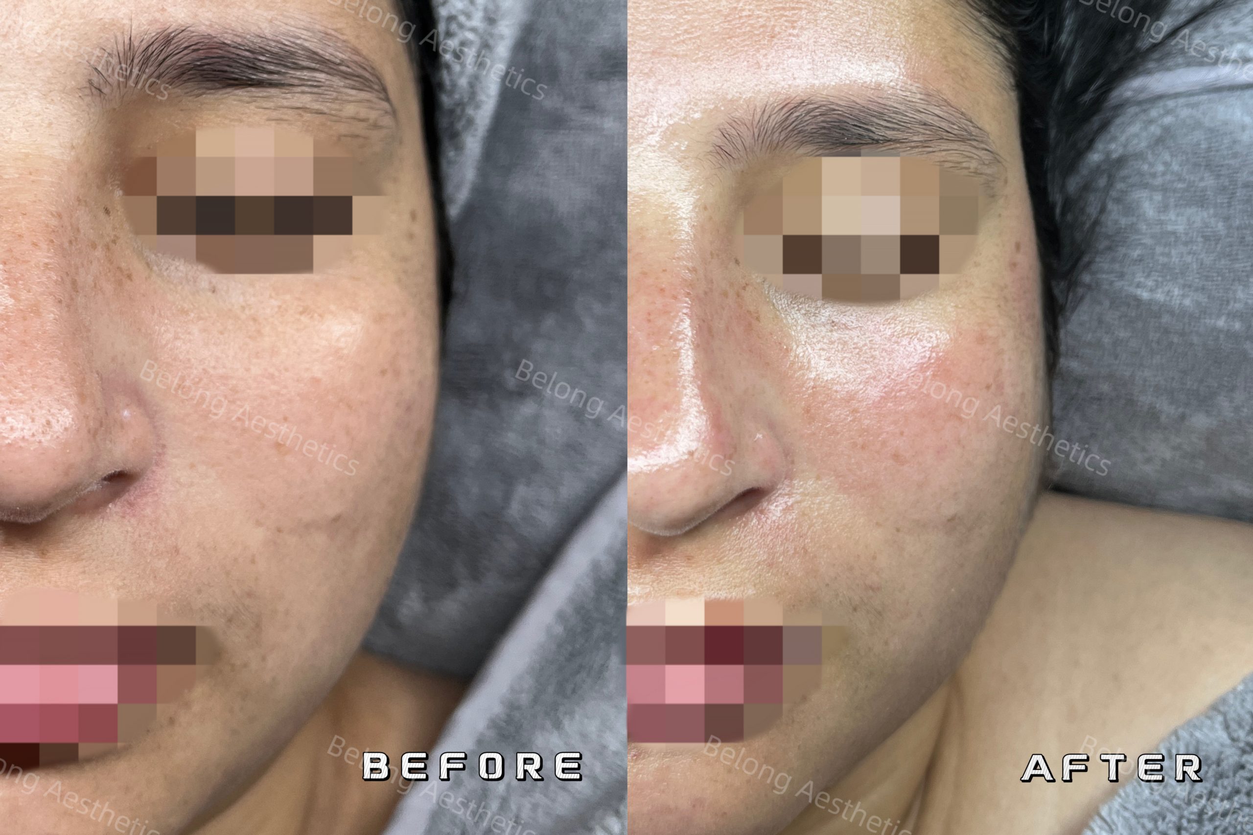 Before & After_Testimonial images_3278