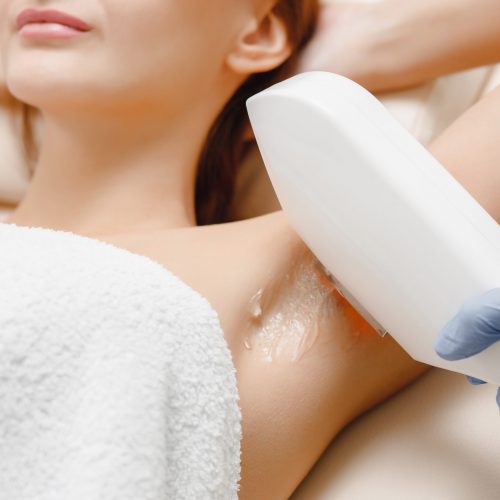 Underarm,Laser,Hair,Removal,Treatment,Woman.,Process,Body,Care.,Health